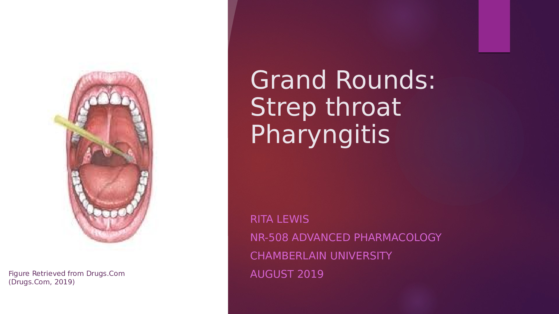 Preview image of NR 508 Grand Rounds Pharyngitis. document