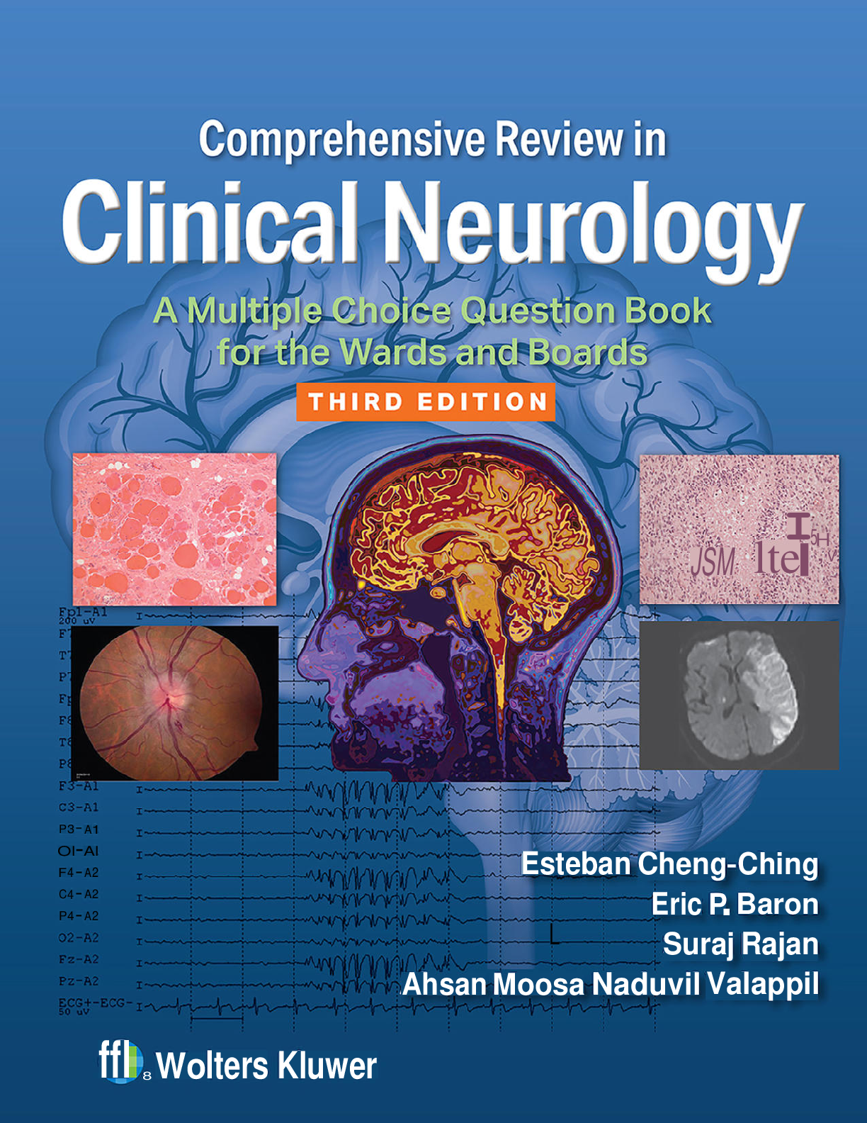Preview of eBook [PDF] Comprehensive Review in Clinical Neurology A Multiple Choice Question Book for